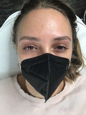 Brow shaping