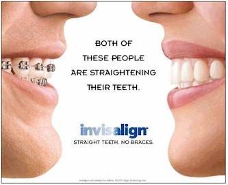 We offer Invisalign or Traditional braces