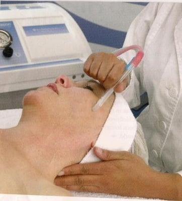 Microdermabrasion treatment