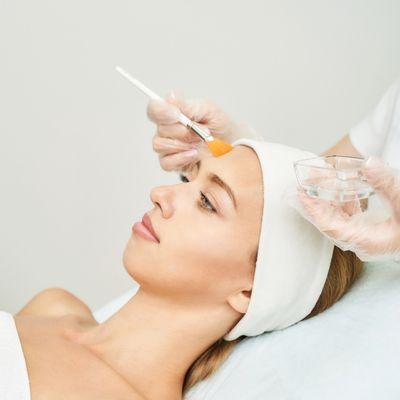 Chemical Peel