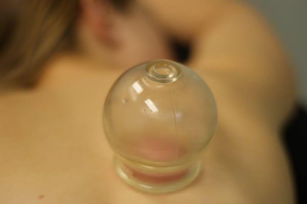 Cupping: a vacuum is created inside a glass cup and applied to the skin.  This technique is used most often to treat pain.