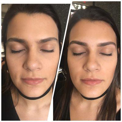 Before and After by Atenea