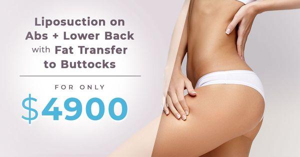 Liposuction Sale! Call us for a FREE consultation