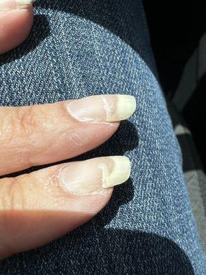 Broken nails from gel manicure