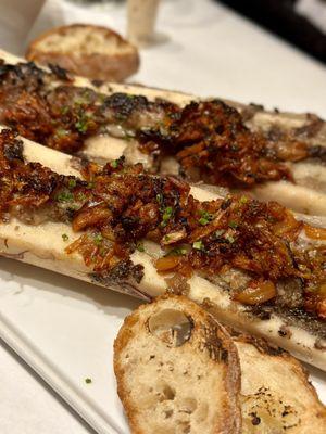 Bone Marrow