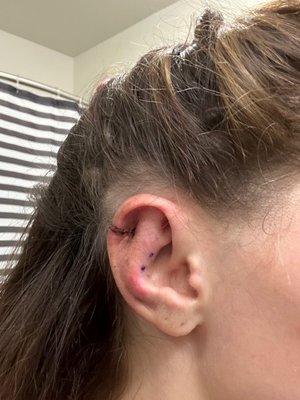 Ears 5 Days Post Op