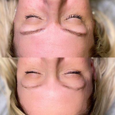 Microblading