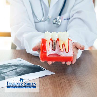 Designer Smiles Dental and Implant Center
  https://dentistanaheimca.com/