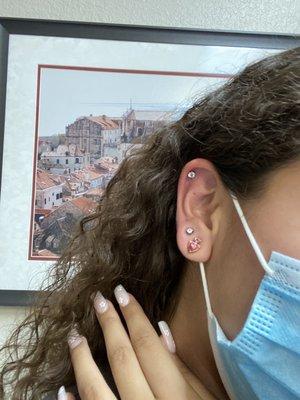 Helix and double lobe