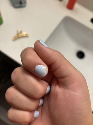 chipped nail