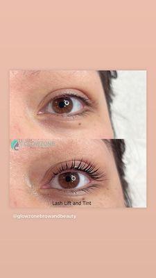 Eyelash lift