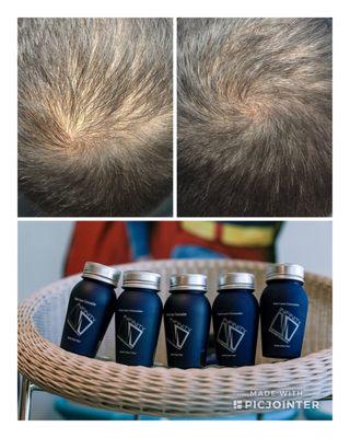 Less dense up top? NO PROBLEM! INFINITY HAIR FIBERS