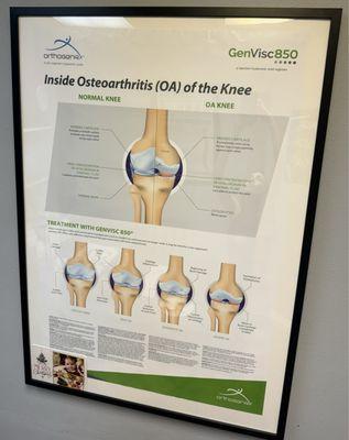 Knee problem chart