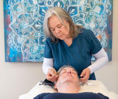 Skin and facial acupuncture specialist