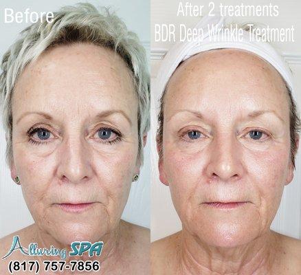 Facial at Alluring Spa & Microblading - Beauty salon Weatherford TX 76086