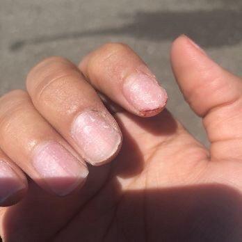 My nails after I had to go to a DIFFERENT salon to get them to take them off