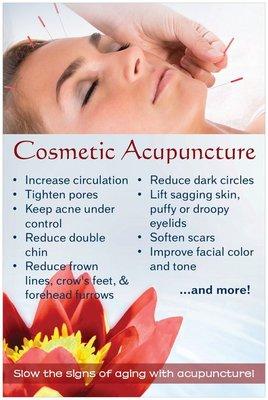 Cosmetic Acupuncture, different from therapeutic, helps to eliminate fine lines & wrinkles!