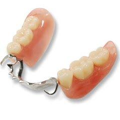 cast metal partial denture