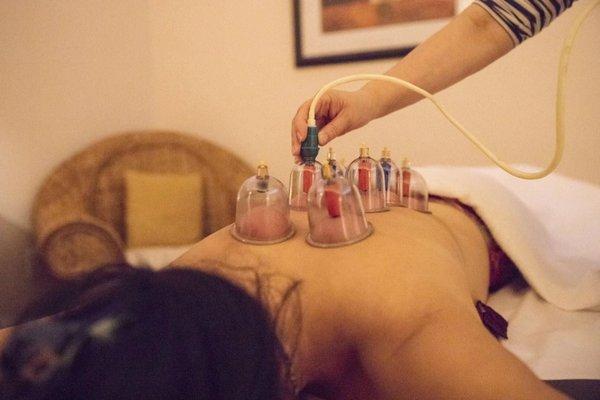 Cupping