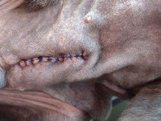 This is Bleu's incision!