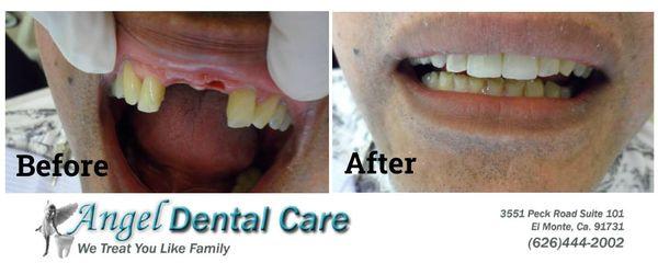 Patient B Before and After Dental Work