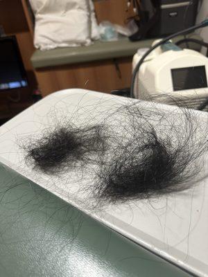 This is what clumps of hair look like. It's continuous and clumps are very big