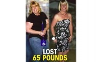 Lost 65 pounds with Oceanside Weight Control