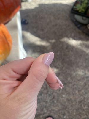 Blemish on my thumb nail