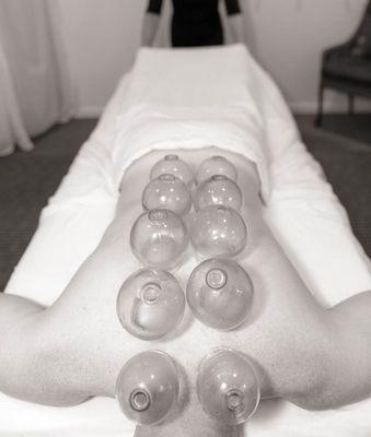 Cupping Massage opens restricted fascia.