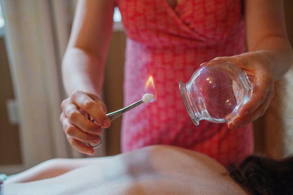 We offer cupping therapy!