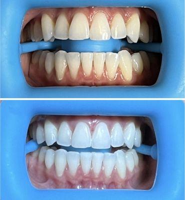 Before and after 60 min session