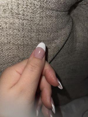 White lines/cracks in all my nails.