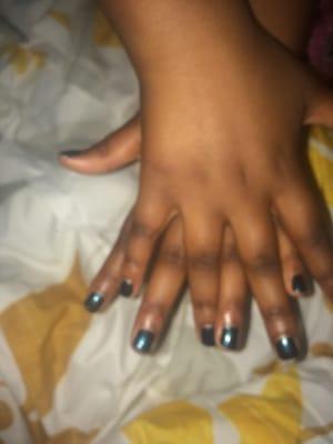 My littlest one's nails...