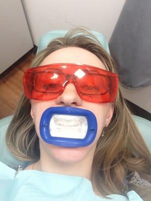 :) whitening! Love this place! Best dentist ever! Amazing staff!!!