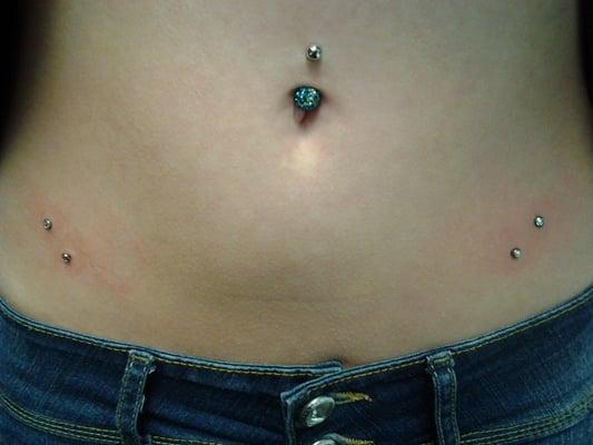 4 Dermal Anchors