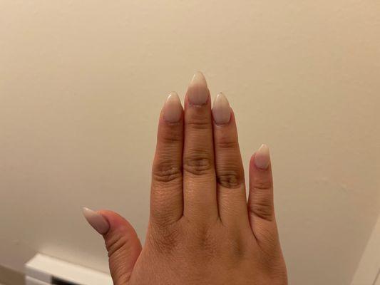 crooked pinky nail and middle finger nail.