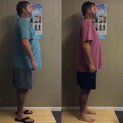 48.6lb weight loss with the clinic's ChiroThin program!!!