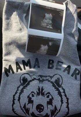 Ultrasound and Merch!