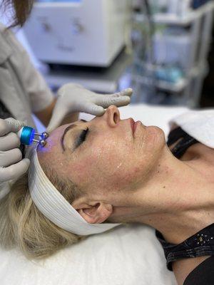 Microcurrent with a mask and Bio Infusion