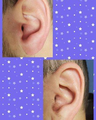 Ear wax