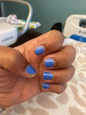 Gel manicure peeling after 4 days