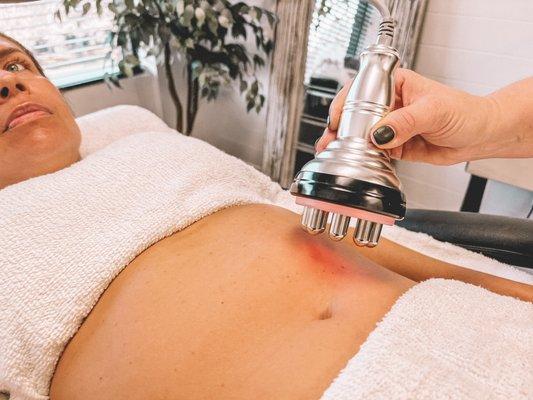 RF Treatment for skin tightening and bloat