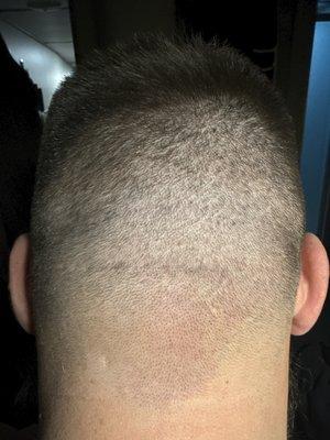 I don't have a before photo but the fade before this was more of several lines that were not blended.