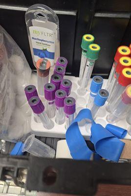 A picture of blood collection sample tubes