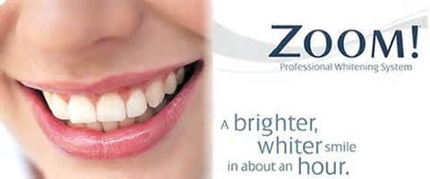 We offer Zoom whitening service