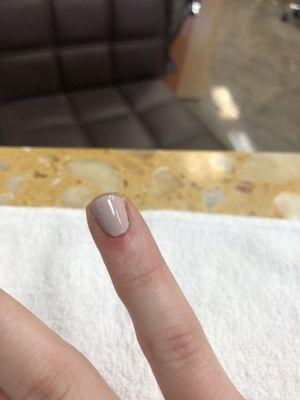 Too much on nail bed/cuticles.