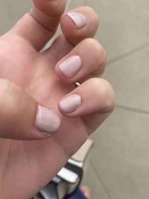 Cut cuticle on pinky