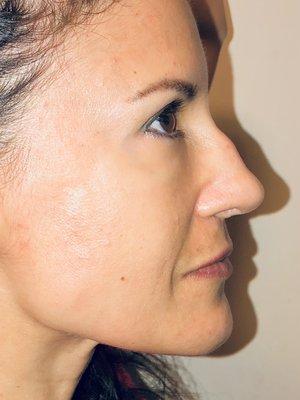 DeRosa Center Facial Aesthetics