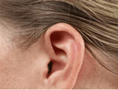 Clear Choice Hearing Solutions