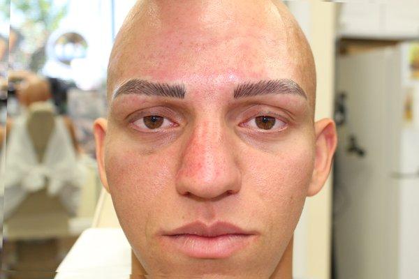 Alopecia Client male liner and new micro-bladed brows that will lighten in a few days